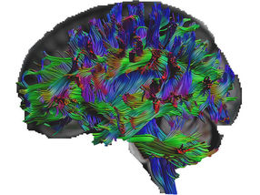 Cómo se ve el cerebro de las personas con gran conocimiento general