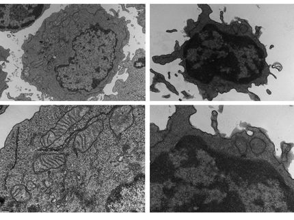 Las células tumorales expresan proteínas en su superficie capaces de modificar el metabolismo inmune