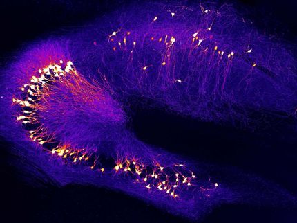 Erstmals früher Schritt der zellulären Störung bei Alzheimer erkannt