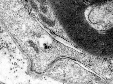 Plan B beim Cholesterintransport