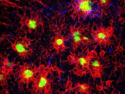 Identificada la relación entre las células inmunitarias cerebrales y el desarrollo de la enfermedad de Alzheimer