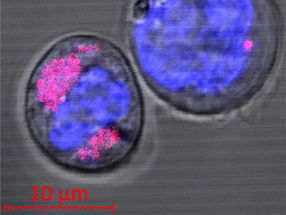 Biologisches Gefahrenpotenzial von Nanopartikeln untersucht