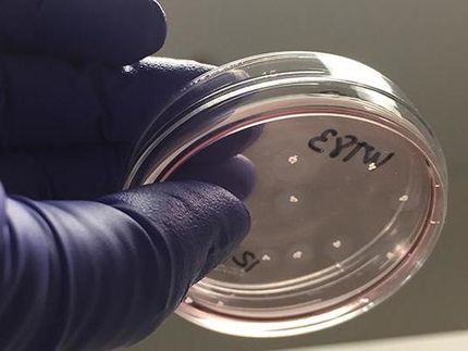 Forscher lassen erbsengroße Miniatur-Gehirne im Labor wachsen