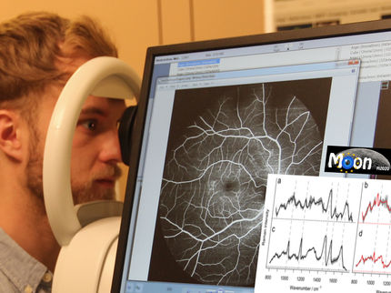 Eye scan makes diseases visible at an early stage