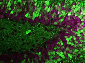 Unique fingerprint: What makes nerve cells unmistakable?