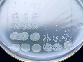 Neue Strategien gegen die Antibiotikakrise