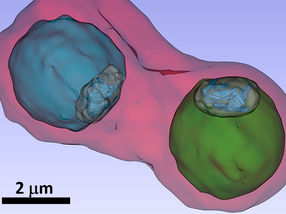 Malaria-Erreger unter dem Röntgen-Mikroskop