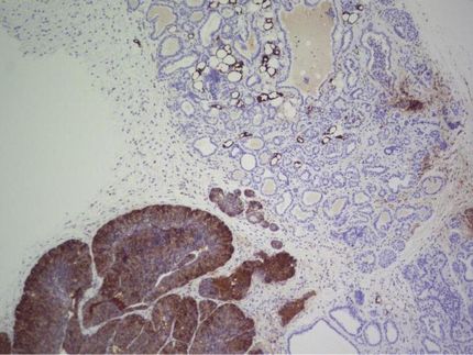 Investigadores del CNIO describen una estrategia molecular que ayudaría a evitar la formación de tumores en ratones