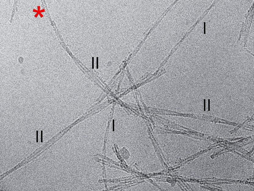 Alzheimer-Auslöser enttarnt - Beta-Amyloid-Fibrillen aus menschlichem Gewebe aufbereitet