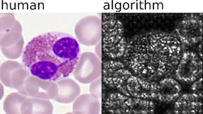 AI-driven single blood cell classification