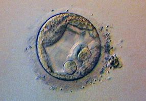 Verlängerung der Embryonenkultur erhöht Aussicht auf ein Baby
