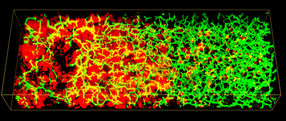 Better diagnosis with 3D model of human liver tissue
