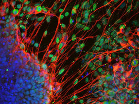 Zelluläre Identität: Wie Stammzellen entscheiden, welche Zelltypen aus ihnen hervorgehen