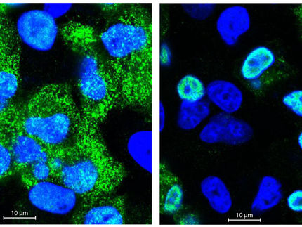 What blocks bird flu in human cells?