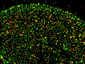 Una proteína recién descubierta da señales de una infección viral