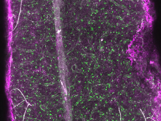 Baccin et al./DKFZ/EMBL