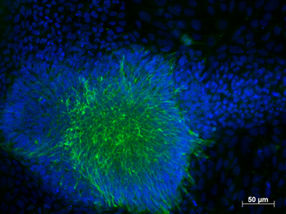 Induziert-pluripotente Stammzellen für die Erforschung von HIV und angeborener Immunantwort