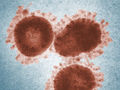 Researchers develop first diagnostic test for novel coronavirus in China