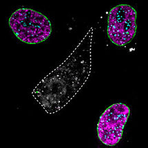 Ein Lichtblitz genügt: Proteine aus der Zelle gezielt verschwinden lassen