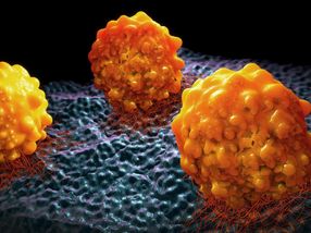 Preventing metastasis by stopping cancer cells from making fat