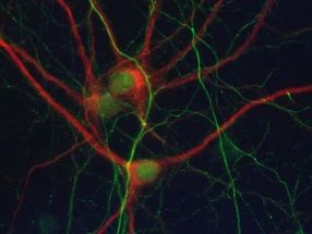 La proteína reelina revierte los principales procesos patológicos asociados al alzhéimer y a otras taupatías