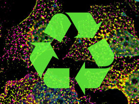 Kiss and run: How cells sort and recycle their components