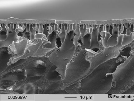 Polymer-Membranen erleichtern Sauerstoffaustausch im Körper