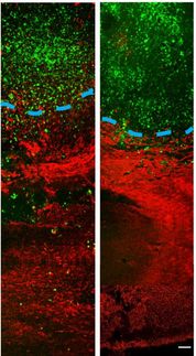 Decreased invasion of the tumor into healthy tissue.