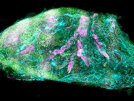 ©Helmholtz Zentrum München / Ertürk Lab