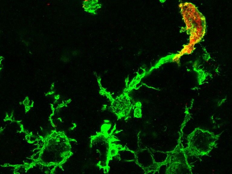 Stroke: Macrophages migrate from the blood - Molecular switch in bone marrow stem cells helps research into inflammatory processes in the brain