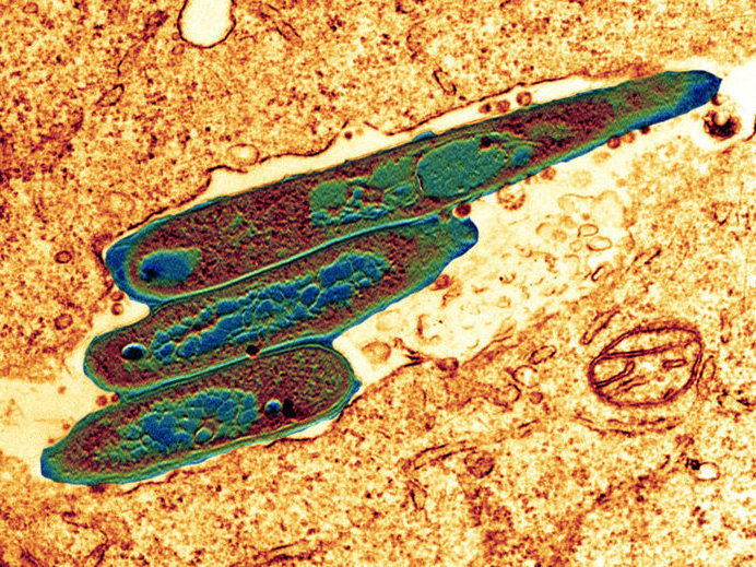 © MPI für Infektionsbiologie - CF Microscopy / Volker Brinkmann