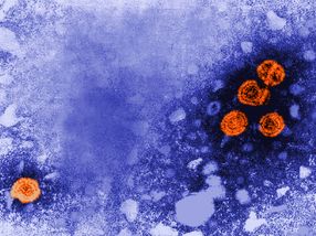 Virus de la Hepatitis B