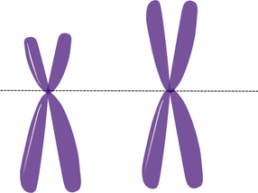 Los cromosomas inestables pueden promover el cáncer de mama