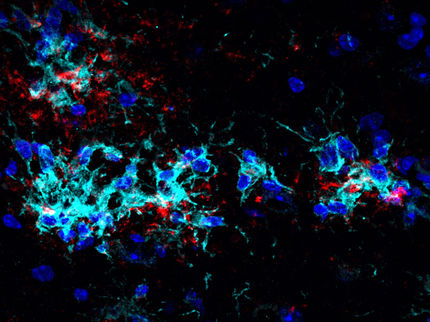 Immunzellen gegen Alzheimer?