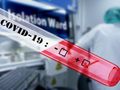 Coronavirus-Test von Roche erhält Notfallzulassung der FDA