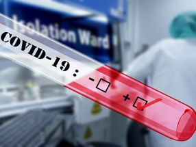 La prueba de SARS-CoV-2 de Roche para detectar el nuevo coronavirus recibe la Autorización de Uso de Emergencia de la FDA