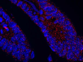 Fehlendes Protein stört Darmschleimhaut und fördert Tumorbildung