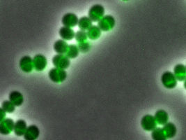 Antibiotikum blockiert Bausteine der Bakterienhülle