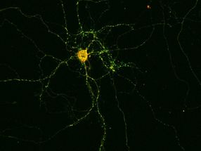 Antikörper im Gehirn lösen Epilepsie aus