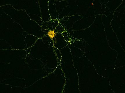 Los anticuerpos en el cerebro desencadenan la epilepsia