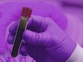 Neuer Bluttest erkennt eine Vielzahl von Krebsarten