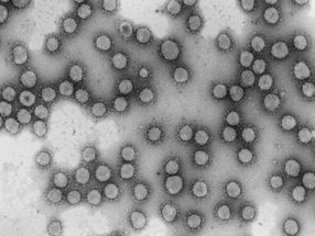 El CSIC impulsa un proyecto de epidemiología genómica para predecir la evolución del nuevo coronavirus