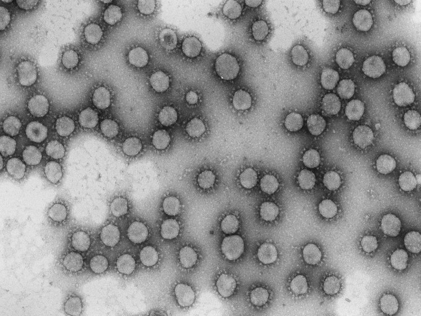 El CSIC impulsa un proyecto de epidemiología genómica para predecir la evolución del nuevo coronavirus - El estudio, financiado con 740.000 euros, comparará los genomas del coronavirus de pacientes infectados, a partir de datos microbiológicos de hospitales de toda España