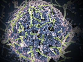 Neuer universeller Ebola-Impfstoff könnte alle vier Virusarten bekämpfen, die den Menschen infizieren