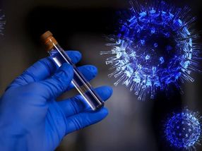 Pharmaindustrie beschleunigt Arbeit an Virus-Tests und Impfstoffen