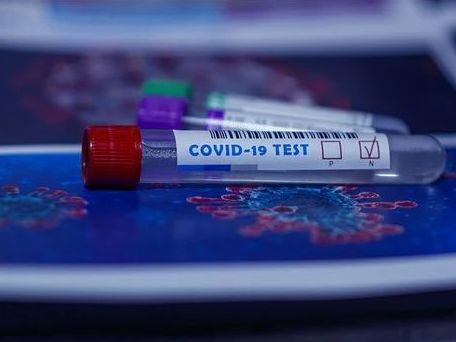 Roche-Diagnostics arbeitet an Test zum Nachweis von Corona-Antikörpern - Man strebe an, den Antikörpertest bis Anfang Mai in Ländern, die die CE-Kennzeichnung der EU akzeptieren, verfügbar zu haben