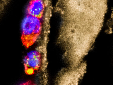 Las larvas del parásito podrían ayudar a combatir las alergias