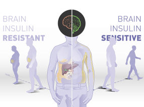 Brain Insulin Sensitivity Determines Body Weight and Fat Distribution