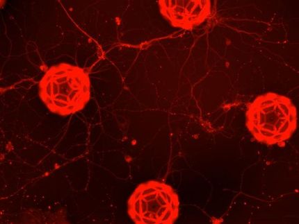 Wie man Nervenzellen in fußballförmige Käfige sperrt