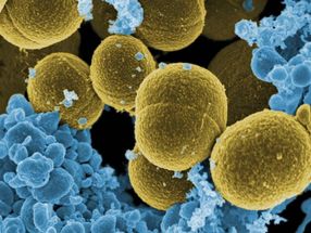 Descubren un mecanismo que regula la actividad patogénica de la bacteria ‘Staphylococcus aureus’